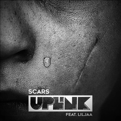 Uplink Scars